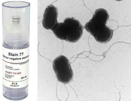 EM Stain 77 with example of negative stain