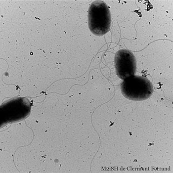example of staining